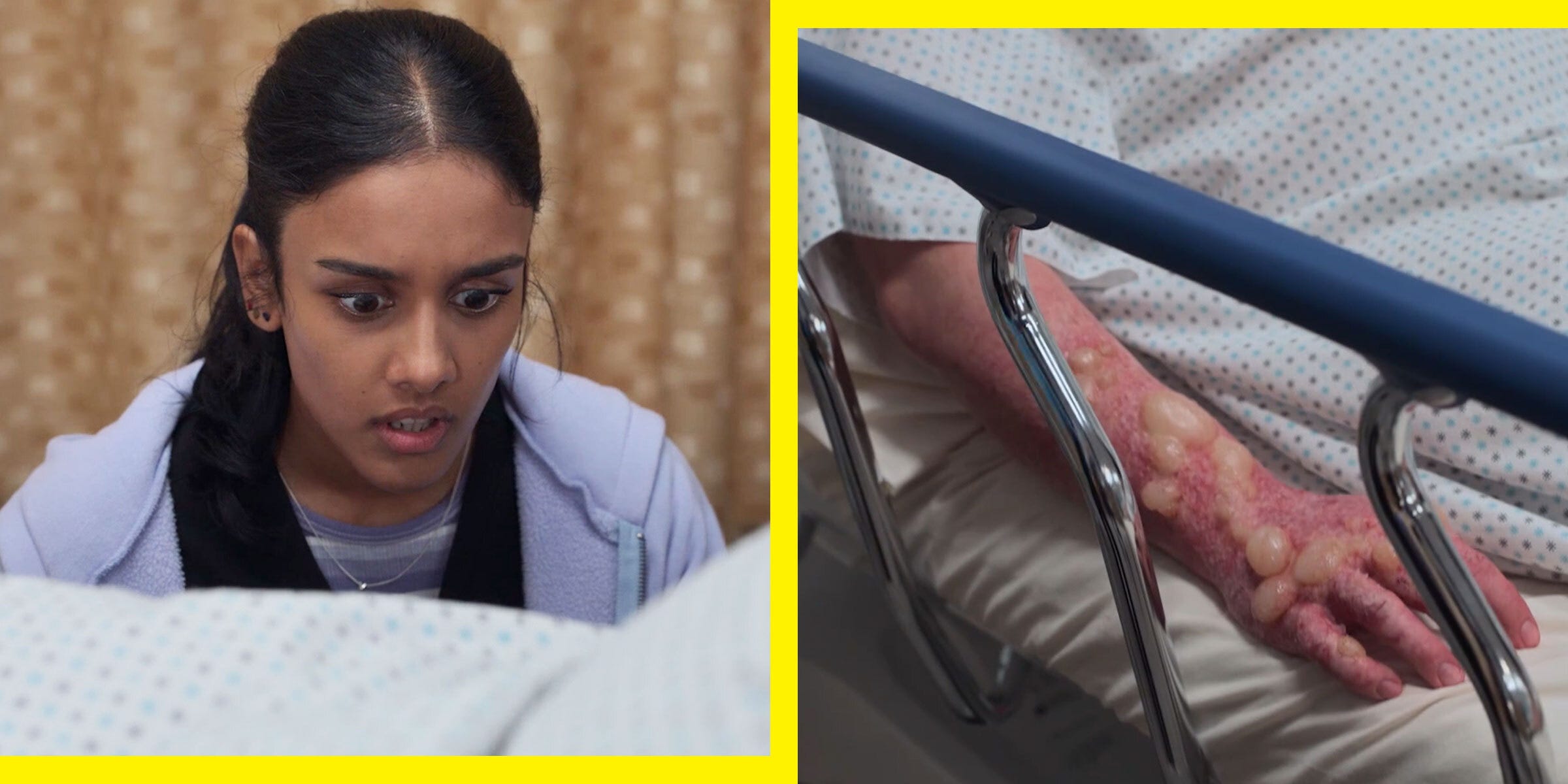 When Sunshine and Citrus Collide: An ER Doctor’s Take on the Gnarly Blisters in ‘The Pitt’ Season 2, Episode 8